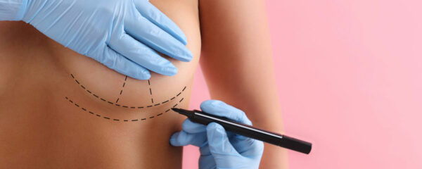 chirurgie mammaire
