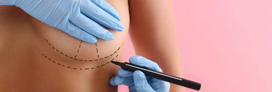 chirurgie mammaire